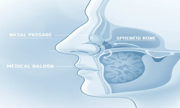 Cranial Facial Release: The Balloon Technique That’s Changing Lives