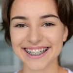 Why Orthodontics? Exploring the Path to a Rewarding Specialty