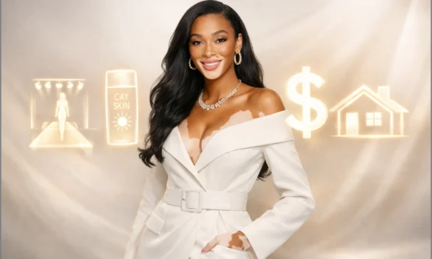 Winnie Harlow Net Worth 2025: How She Built Her $5M Fortune